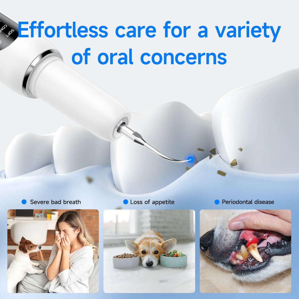 Ultrasonic electric dental scaler for teeth cleaning ™